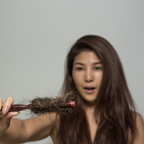 The Quiet Hair Loss Epidemic Among Women